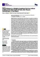 Plaque rupture in a Hodgkin lymphoma survivor without cardiovascular risk factors 20 years after thoracic radiotherapy