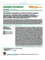 Psammomatoid ossifying fibroma is defined by SATB2 rearrangement