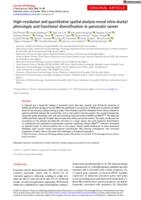 High-resolution and quantitative spatial analysis reveal intra-ductal phenotypic and functional diversification in pancreatic cancer