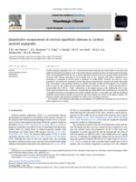 Quantitative measurement of cortical superficial siderosis in cerebral amyloid angiopathy