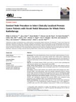 Sentinel node procedure to select clinically localized prostate cancer patients with occult nodal metastases for whole pelvis radiotherapy