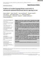 Evidence of cerebral hypoperfusion consecutive to ultrasound-mediated blood-brain barrier opening in rats