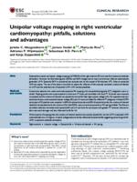 Unipolar voltage mapping in right ventricular cardiomyopathy