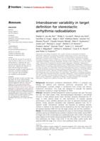 Interobserver variability in target definition for stereotactic arrhythmia radioablation