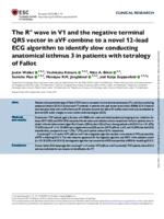 The R" wave in V1 and the negative terminal QRS vector in aVF combine to a novel 12-lead ECG algorithm to identify slow conducting anatomical isthmus 3 in patients with tetralogy of Fallot