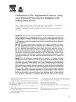 Evaluation of the angiosome concept using near-infrared fluorescence imaging with indocyanine green