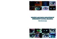 Scientific and clinical implications of heterogeneity in uveal melanoma