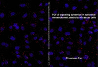 TGF-β signaling dynamics in epithelial-mesenchymal plasticity of cancer cells