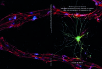 Modeling vascular disease using self-assembling human induced pluripotent stem cell derivatives in 3D vessels-on-chip