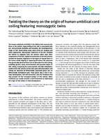 Twisting the theory on the origin of human umbilical cord coiling featuring monozygotic twins