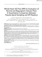 Whole-heart 4D flow MRI for evaluation of normal and regurgitant valvular flow