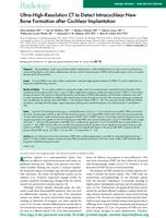 Ultra-high-resolution CT to detect intracochlear new bone formation after cochlear implantation